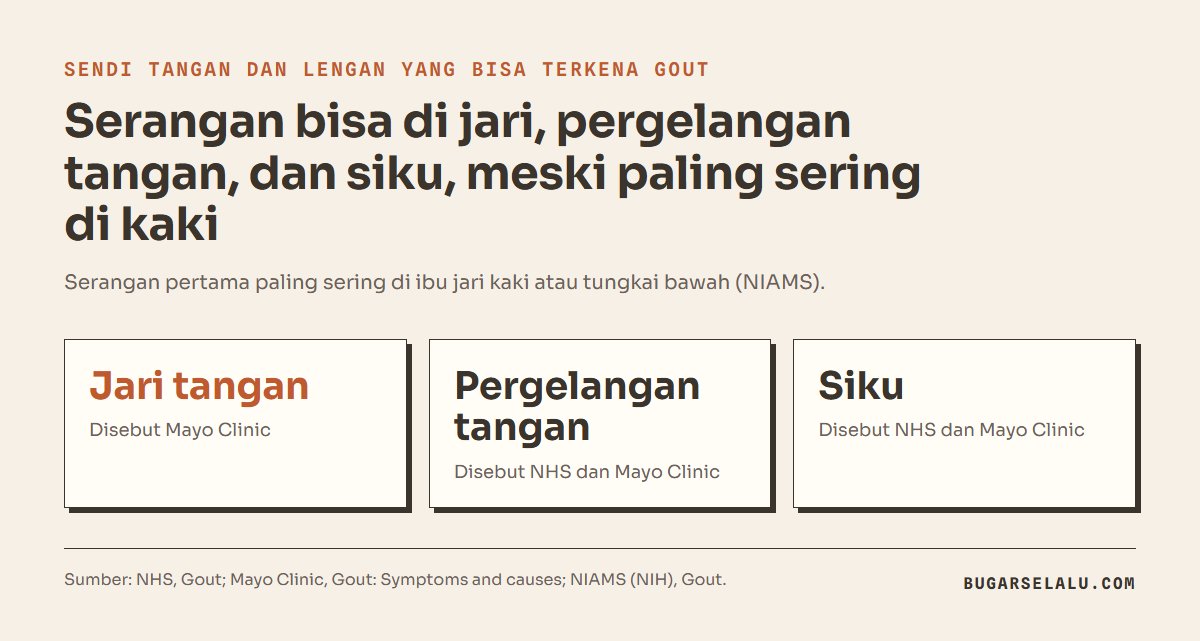 Kartu sendi tangan dan lengan yang bisa terkena gout: jari tangan, pergelangan tangan, dan siku, meski serangan pertama paling sering di ibu jari kaki