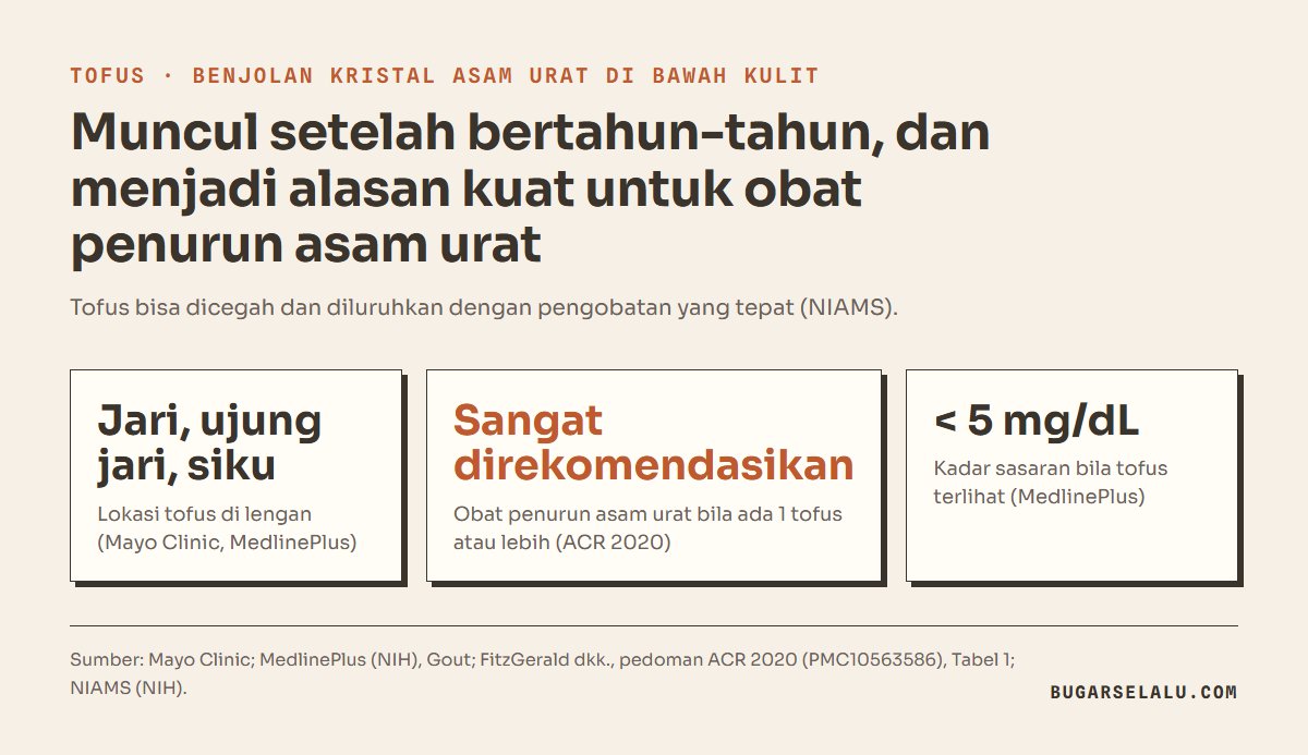 Kartu tentang tofus: lokasi di jari, ujung jari, dan siku; obat penurun asam urat sangat direkomendasikan ACR 2020 bila ada satu tofus atau lebih; kadar sasaran di bawah 5 mg/dL bila tofus terlihat