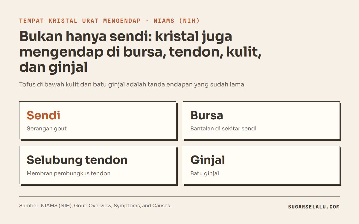 Kartu empat tempat kristal urat mengendap menurut NIAMS: sendi, bursa, selubung tendon, dan ginjal