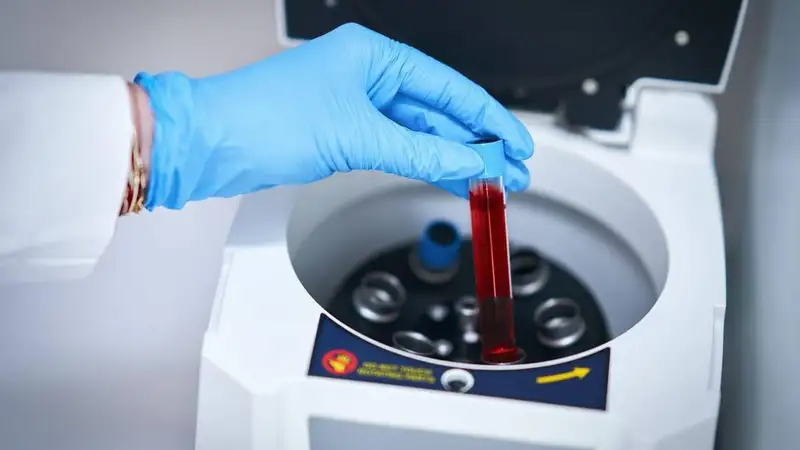 Tangan bersarung tangan biru memasukkan tabung berisi sampel darah ke dalam alat sentrifus di laboratorium.