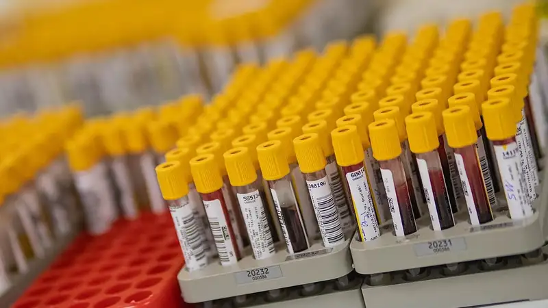 Deretan tabung sampel darah bertutup kuning berlabel barcode tersusun di rak laboratorium klinik.